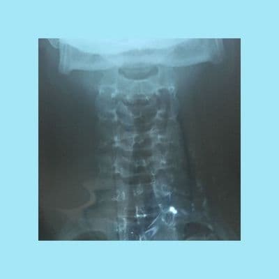 Product cover